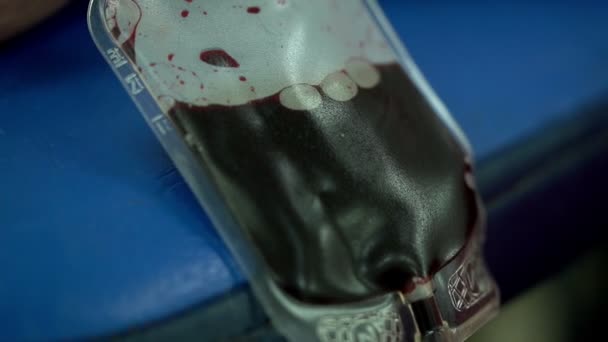 Recipiente Para Recoger Sangre Donada Realizar Ejercicios Especiales Con Mano — Vídeos de Stock