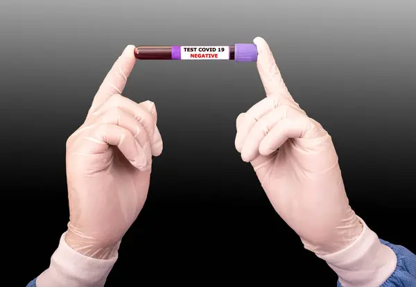 Руки Тримають Тестову Трубку Містить Зразок Крові Негативним Результатом Covid — стокове фото