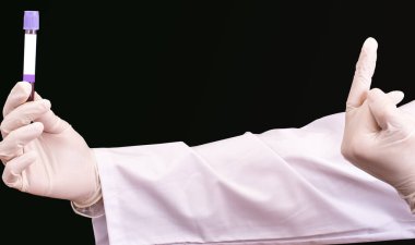 Hand in white disposable glove shows middle finger to a tube with infected blood of Covid-19 with space for text on the label. Fuck you Coronavirus