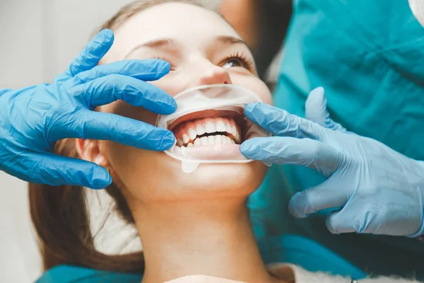 Lekarz patrzy na zęby pacjentów profesjonalnej higieny jamy ustnej. — Zdjęcie stockowe