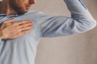 Hiperhidrozlu bir adam mavi gömlekli, gri gömlekli, koltuk altında çok kötü terliyor.