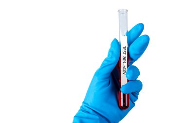Mavi eldivenli bir el kan şişelerini tutar. Corona testi.
