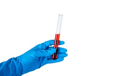 Mavi eldivenli bir el kan şişelerini tutar. Corona testi.