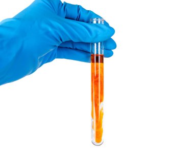 Mavi eldivenli bir el sarı sıvı şişeleri tutar. bunun için test