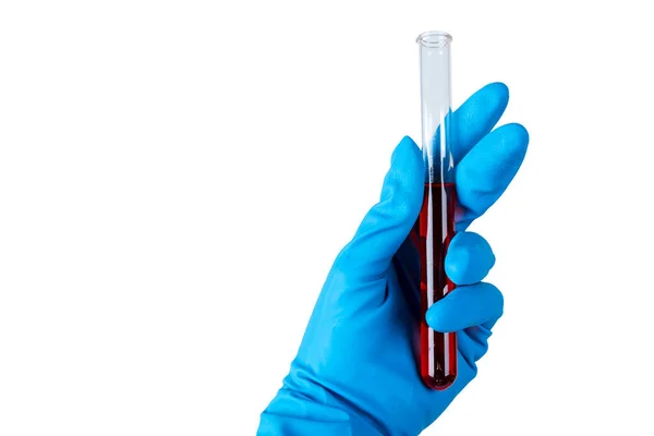 Una Mano Blu Guantata Contiene Fiale Sangue Test Corona — Foto Stock