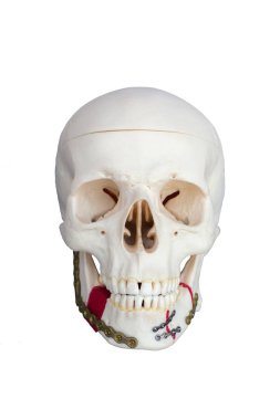 Sakızdan yapılmış kafatası. Kırık çene, plaka vidasıyla sabitlenmiş. Beyaz Arkaplanda.