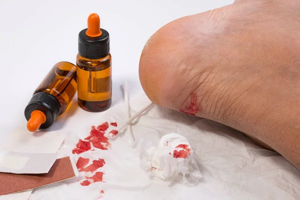 Fresh bleeding wounds on heel with first aid supplies, first aid equipment or emergency medical products. — Stock Photo, Image