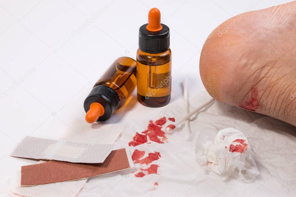 Fresh bleeding wounds on heel with first aid supplies, first aid equipment or emergency medical products.