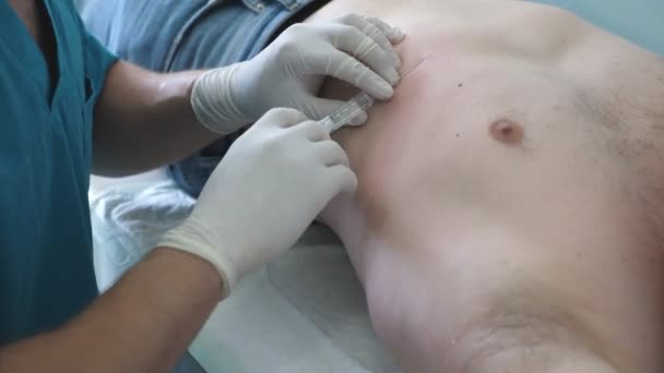 La mano del medico maschio fa un'iniezione al corpo del paziente prima dell'operazione. L'anestesista fa l'anestesia. Pugnalate mediche con ago nelle costole, braccio con guanti chirurgici protettivi. Da vicino. — Video Stock