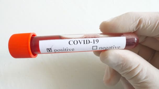 Amostras de sangue para COVID-19 no braço do médico com luvas de proteção. Mão de médico segurando tubo de teste com amostra de sangue para coronavírus em fundo branco. Conceito de saúde e segurança da pandemia — Vídeo de Stock