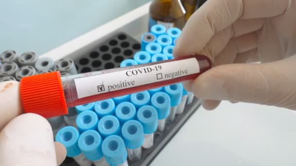 Ruka lékaře držícího zkumavku se vzorkem krve na koronavirus. Paže zdravotníka s ochrannými rukavicemi testujícími vzorky krve v laboratoři. Koncept bezpečnosti a ochrany zdraví před pandemií COVID-19 — Stock video
