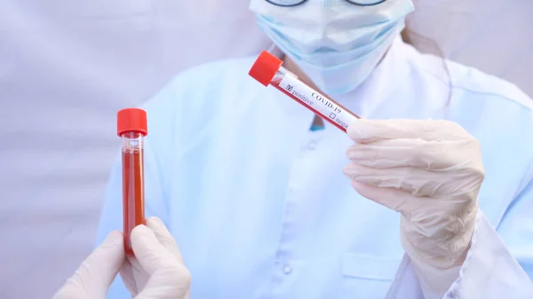 两名医生用验血试管来探查考罗那韦的血样 携带防护手套的男医生和女医生检测血液样本 Covid 19大流行病的健康和安全寿命概念 — 图库照片