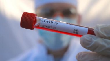 Koruyucu eldivenli bir doktorun eli COVID-19 virüsüne kan örneği test ediyor. Coronavirus 'a kan örneği taşıyan test tüpünü tutan sıhhiye kolu. Salgından korunan sağlık ve güvenlik kavramı. Kapat.