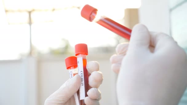 Tubos de teste com amostras de sangue para coronavírus na mão do médico ou funcionário do laboratório. Braço de exames médicos amostras de sangue de pacientes para o vírus COVID-19. Conceito de saúde e segurança vida de pandemia. Fechar. — Vídeo de Stock