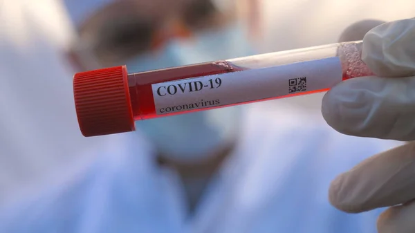 医生手拿防护手套 检测Covid 19病毒血液样本 用血样夹持内科试管臂至冠状病毒 流行病对健康和安全生命的影响概念 靠近点 — 图库照片