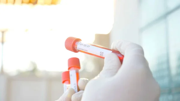 医生或实验室工作人员手里拿着带血样的验尸管 检测Covid 19病毒患者血液样本的医学臂 流行病对健康和安全生命的影响概念 — 图库照片