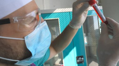 Coronavirus 'a kan örneği veren bir bilim adamının test tüpü profili. Koruyucu gözlüklü genç bir laboratuvar çalışanı COVID-19 'un kan örneklerini inceliyor. Korona virüsü salgınından korunmak için.