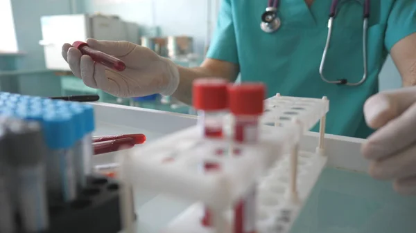 科学家在Covid 19中检测血液样本 并在实验室的架子上添加试管 医生用血样检查输卵管 检查结肠病毒 科罗纳病毒大流行后的健康和安全生命概念 — 图库照片