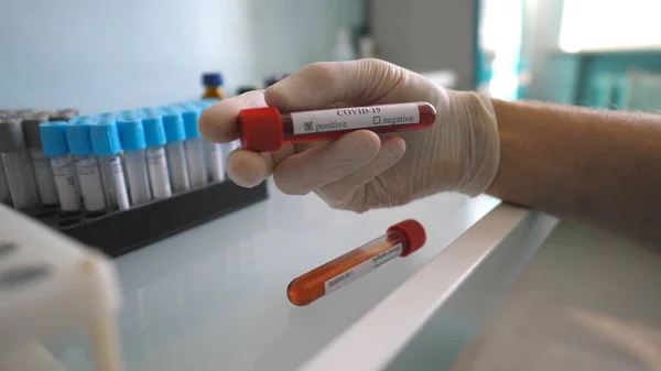 Arm Scientist Protective Gloves Tests Test Tube Blood Sample Coronavirus — Stock Photo, Image