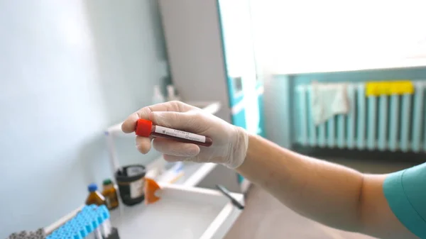 血液サンプルを用いた検査管をコロナウイルスに検査する科学者 Covid 19に血液サンプルを保護手袋テストしているラボ作業員 コロナウイルスのパンデミックによる健康と安全の概念 — ストック写真