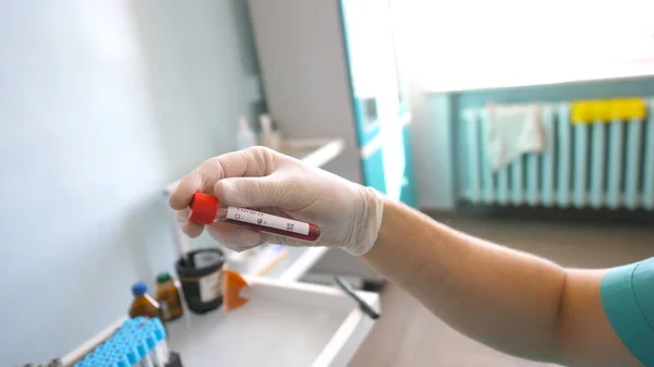 Tudósok Vérmintával Vizsgálják Kémcsövet Koronavírusnak Laboratóriumi Dolgozó Védőkesztyűvel Vérmintákat Tesztel — Stock Fotó
