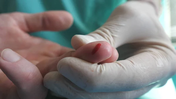 Врач Берет Образец Крови Пальца Пациента Анализа Covid Руки Медика — стоковое фото
