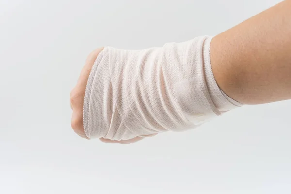 Os de la main brisé par accident avec attelle de bras — Photo