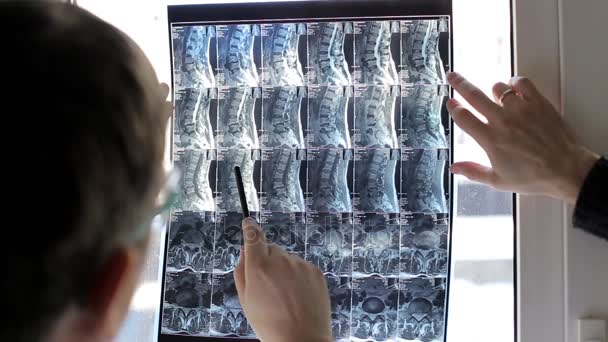 Two doctors examining patients X-rays in hospital — Stock Video