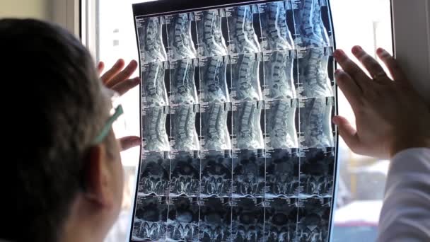 Medico che esamina i pazienti radiografie in ospedale — Video Stock