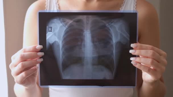 Akciğer radyografi konsepti. Virüs ve bakteri insan ciğerlerine bulaştı. Akciğer kanseri veya zatürree hastası.. — Stok video