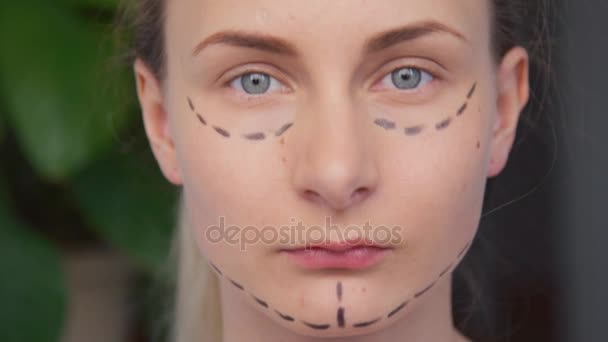 Femme chirurgie plastique marques sur le visage — Video