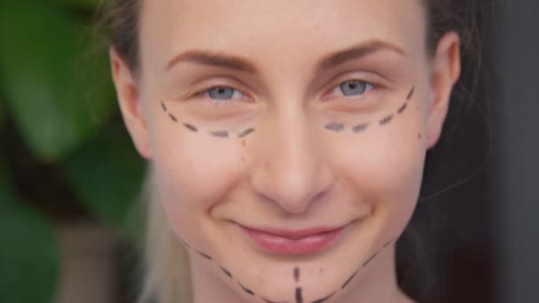 Kvinna plastikkirurgi markeringar på ansikte — Stockvideo