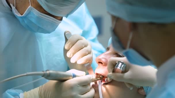 Zubní lékařství. zubní ošetření closeup — Stock video