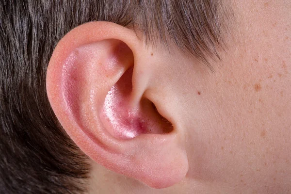 Joven caucásico adolescente oreja —  Fotos de Stock