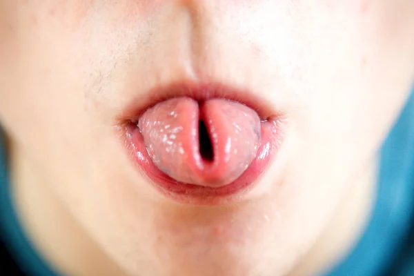 Close up of parts of a human face — Stock Photo, Image