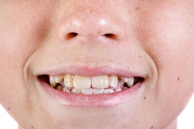 Beyaz ve genç genç çocuğun yüzünü