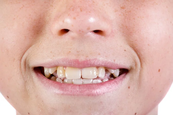 Beyaz ve genç genç çocuğun yüzünü