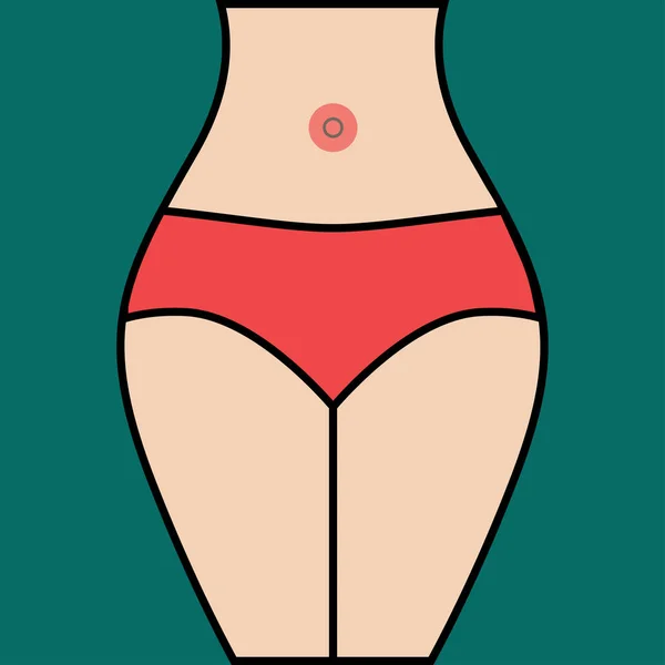 Kvinna med navelbråck — Stock vektor