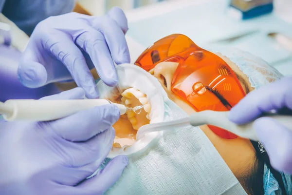 Procedura di sbiancamento dei denti — Foto Stock