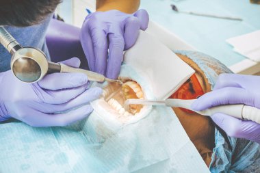 diş beyazlatma işlemi