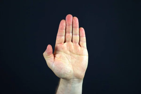 Stock image Hand in the black 