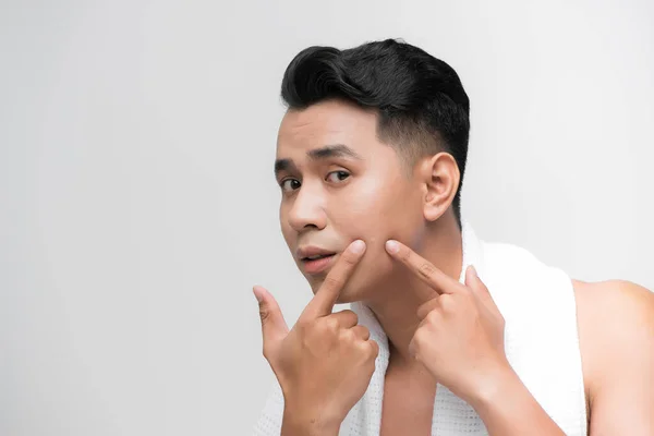 Junger Mann Überprüft Seine Haut Pflegekonzept Für Männer Akne Behandlung — Stockfoto