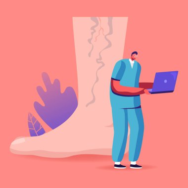 Ayak Sağlığı Hizmetleri, ayak hastalıkları konsepti. Tiny Doctor Character, Hastalıklı Örümcek Damarları ile Dev Ayak 'taki dizüstü bilgisayarda Thrombosis ve Varicose Tedavisi hakkında bilgi arıyor. Çizgi film Vektör İllüstrasyonu