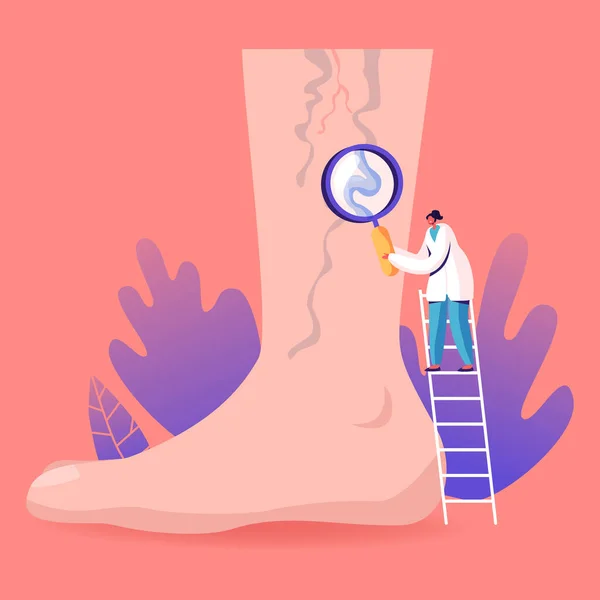 Thrombose veineuse et concept de traitement de la varice. Tiny Doctor Character Stand on Ladder with Magnifying Glass Looking on Huge Foot with Diseased Veins. Soins de santé, podiatrie. Illustration vectorielle de bande dessinée — Image vectorielle