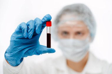 Coronavirus testi için eldiven içinde kan örneği tutan konsantre bir doktor.