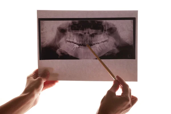 Ruka držící RTG čelisti a zubů — Stock fotografie