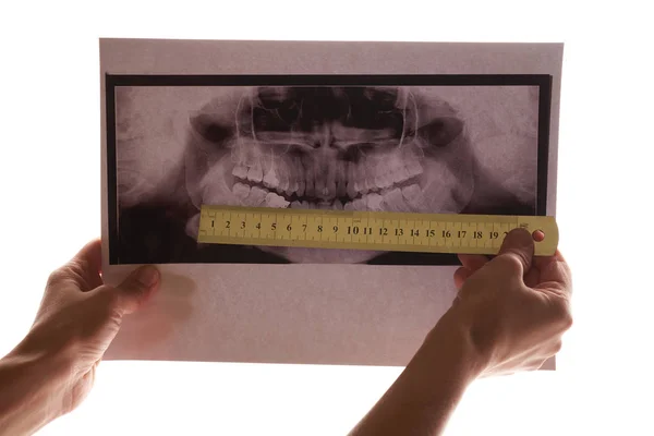 Hand hält Röntgenbild des Kiefers und der Zähne — Stockfoto