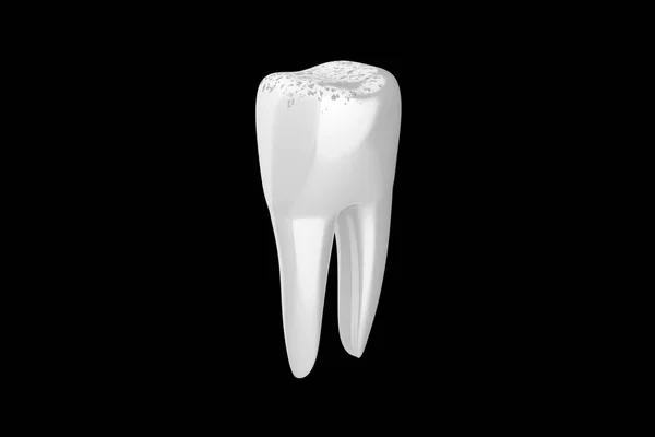 सफेद दांत स्पिन क्षरण के साथ — स्टॉक फ़ोटो, इमेज