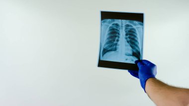 Tıbbi rapor. Coronavirüs 'ten sonra hastayı iyileştir. Sağlıklı insan akciğerleri.