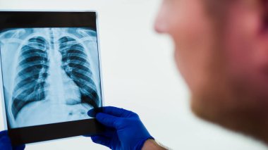 Ciğerlerin röntgeni bir doktorun elinde. Doktor ameliyathanede röntgene bakıyor.